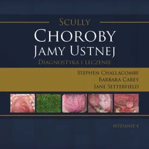 Scully. Choroby jamy ustnej
