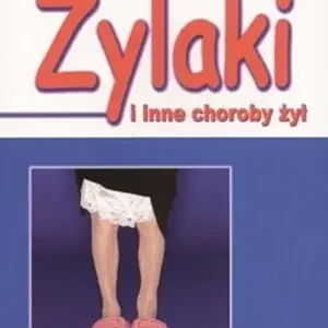 Żylaki i inne choroby żył