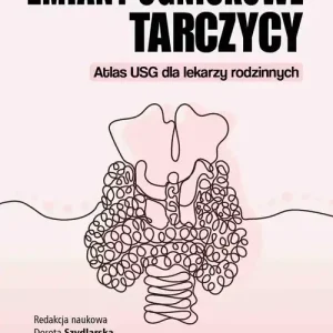 Zmiany ogniskowe tarczycy. Atlas USG dla lekarzy rodzinnych