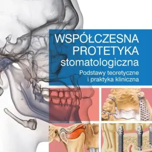 Współczesna protetyka stomatologiczna