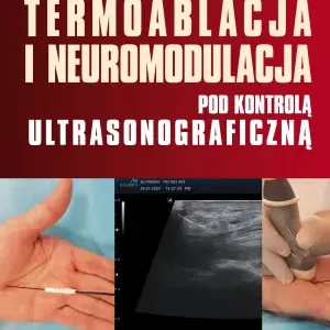 Termoablacja i neuromodulacja pod kontrolą ultrasonograficzną